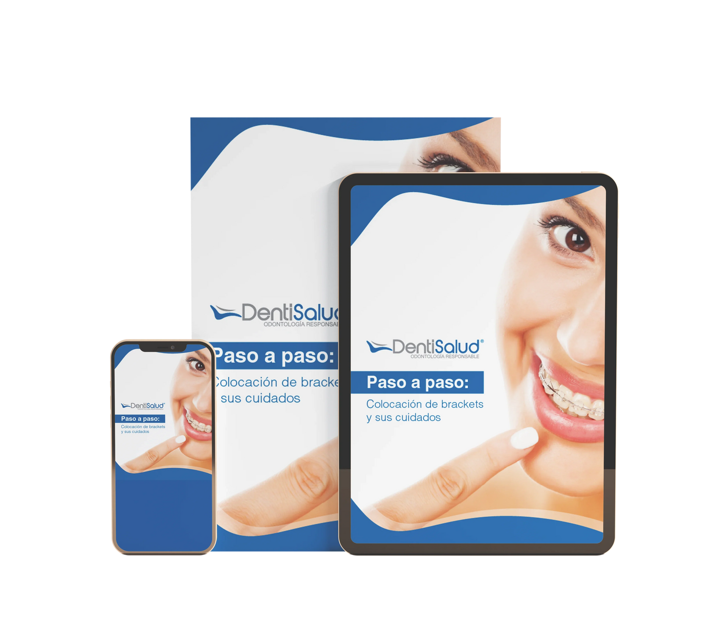 La Colocación De Brackets Y Sus Cuidados - Ebook By DentiSalud